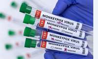 Zahedan University of Medical Sciences scales up monkeypox surveillance amid growing outbreak in neighboring countries 